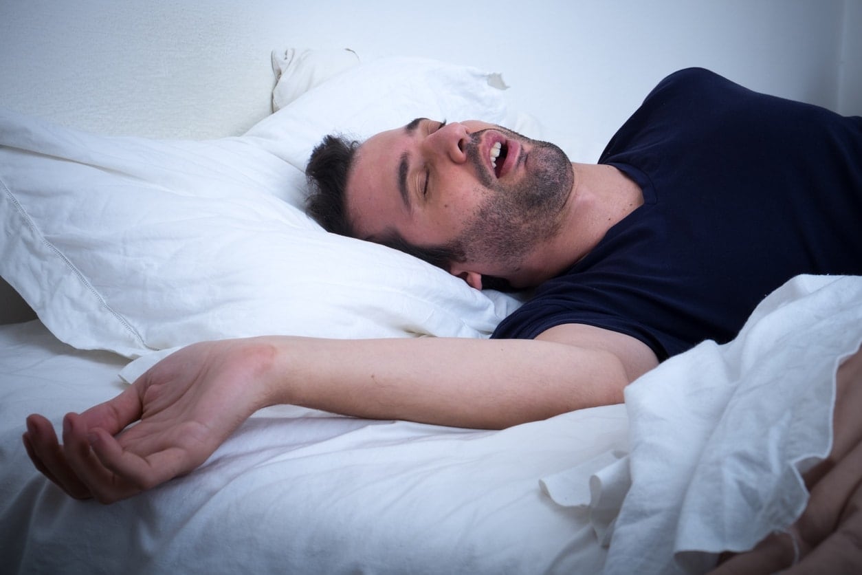 CPAP Vs. Oral Appliance Therapy for Sleep Apnea in