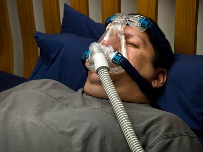 CPAP Alternative | Marc Levin |