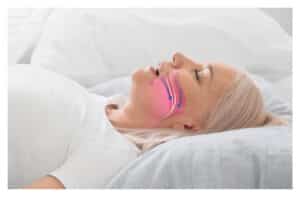 Medical illustration depicting the airway during obstructive sleep apnea, showing collapsed soft tissues blocking airflow during sleep.